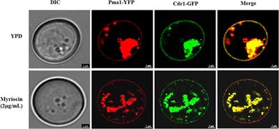 Myriocin enhances the antifungal activity of fluconazole by blocking the membrane localization of the efflux pump Cdr1
